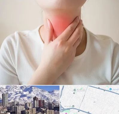 دکتر سرطان مری در ازگل