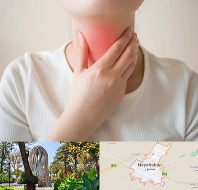 دکتر سرطان مری در نیشابور