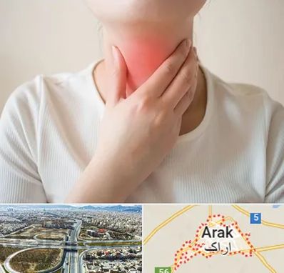 دکتر سرطان مری در اراک