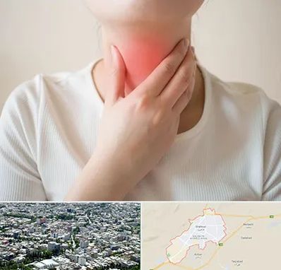 دکتر سرطان مری در شاهرود