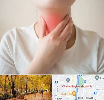 دکتر سرطان مری در چهارباغ اصفهان 