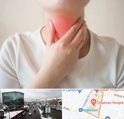 دکتر سرطان مری در اقدسیه