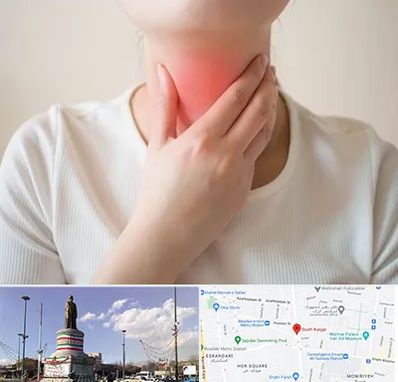 دکتر سرطان مری در کارگر جنوبی 