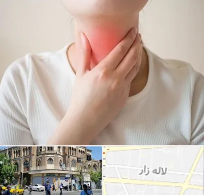 دکتر سرطان مری در لاله زار