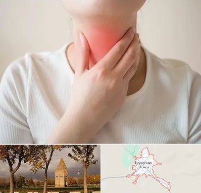 دکتر سرطان مری در تویسرکان