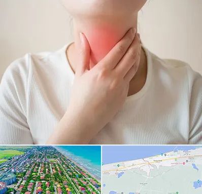 دکتر سرطان مری در فریدونکنار