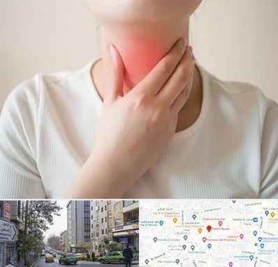 دکتر سرطان مری در فاطمی