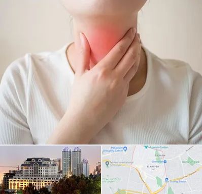 دکتر سرطان مری در فرشته 