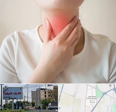 دکتر سرطان مری در فاز یک اندیشه