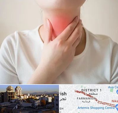 دکتر سرطان مری در فرمانیه 