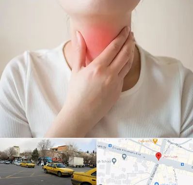 دکتر سرطان مری در شهناز تبریز