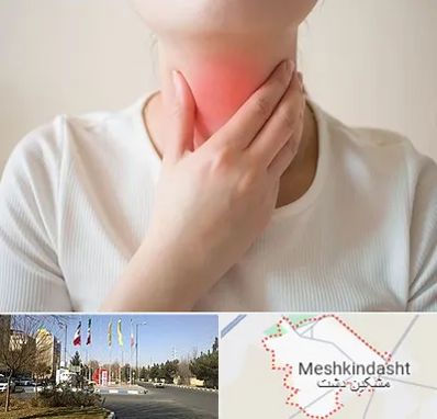 دکتر سرطان مری در مشکین دشت