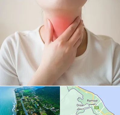 دکتر سرطان مری در رامسر