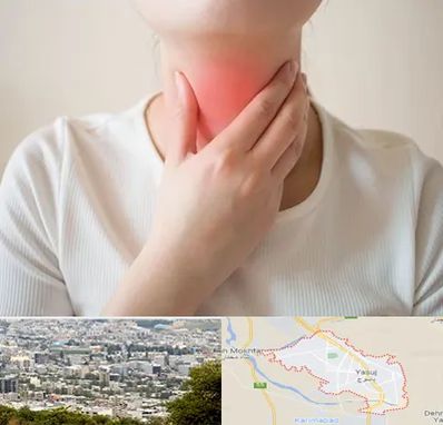 دکتر سرطان مری در یاسوج