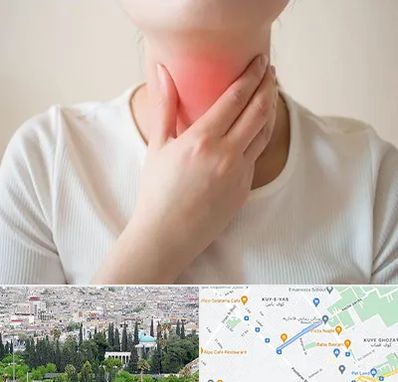 دکتر سرطان مری در محلاتی شیراز 