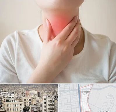 دکتر سرطان مری در اسکندری