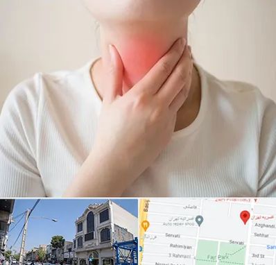 دکتر سرطان مری در افسریه