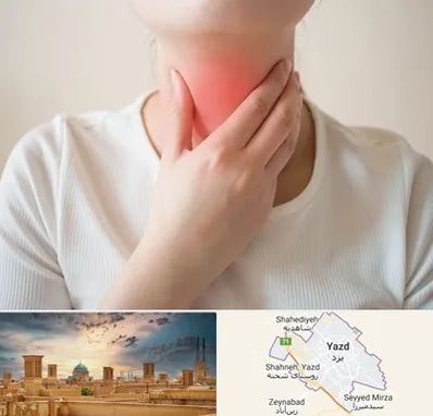 دکتر سرطان مری در یزد