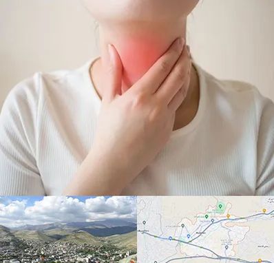دکتر سرطان مری در رودهن