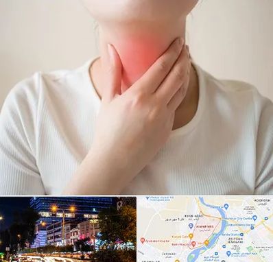 دکتر سرطان مری در کیانپارس اهواز 