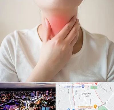 دکتر سرطان مری در گلسار رشت 