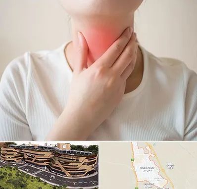 دکتر سرطان مری در شاهین شهر