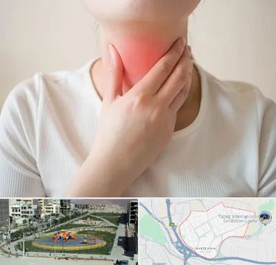 دکتر سرطان مری در مرزداران تبریز