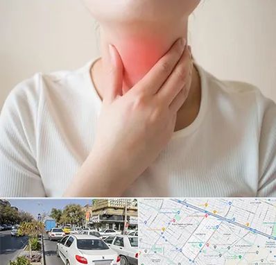 دکتر سرطان مری در مفتح مشهد 