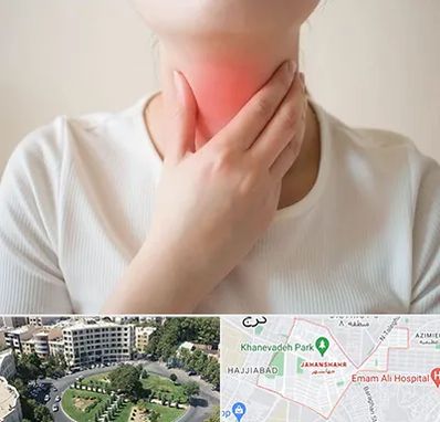 دکتر سرطان مری در جهانشهر کرج 