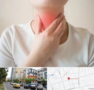 دکتر سرطان مری در هفده شهریور تبریز