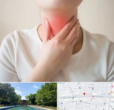 دکتر سرطان مری در هشت بهشت اصفهان 