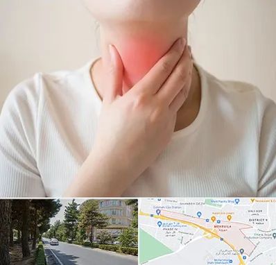 دکتر سرطان مری در مهرویلا کرج 