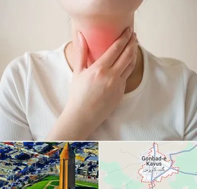 دکتر سرطان مری در گنبد کاووس