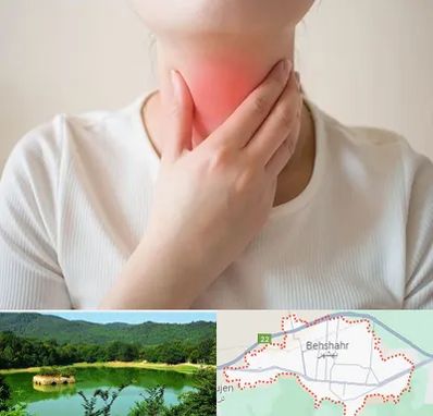 دکتر سرطان مری در بهشهر