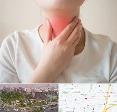 دکتر سرطان مری در آیت الله کاشانی