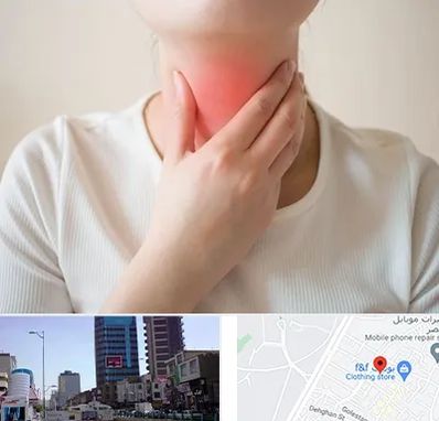 دکتر سرطان مری در چهارراه طالقانی کرج 