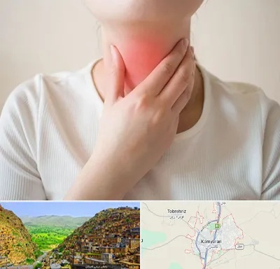 دکتر سرطان مری در کامیاران