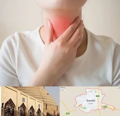دکتر سرطان مری در ساوه