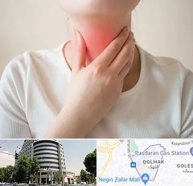 دکتر سرطان مری در قلهک 