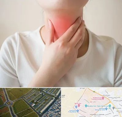 دکتر سرطان مری در الهیه مشهد 