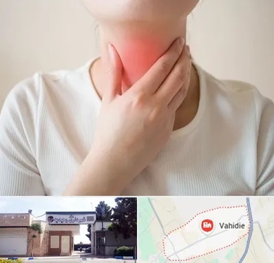 دکتر سرطان مری در وحیدیه شهریار