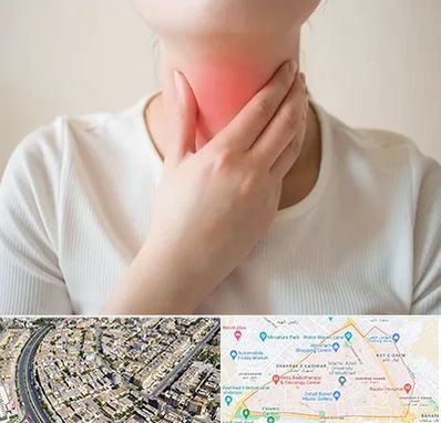 دکتر سرطان مری در شهرک غرب مشهد 