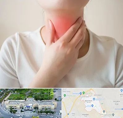 دکتر سرطان مری در نسیم شهر