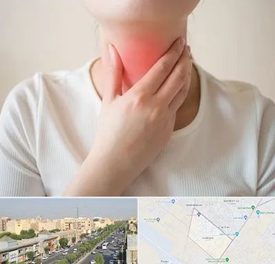 دکتر سرطان مری در کیانمهر کرج 