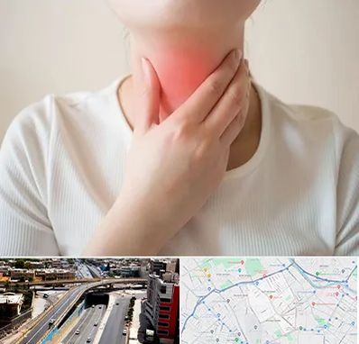 دکتر سرطان مری در ستارخان شیراز 