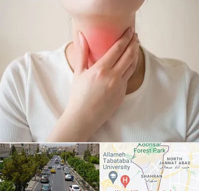 دکتر سرطان مری در شهران 