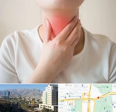 دکتر سرطان مری در حقانی