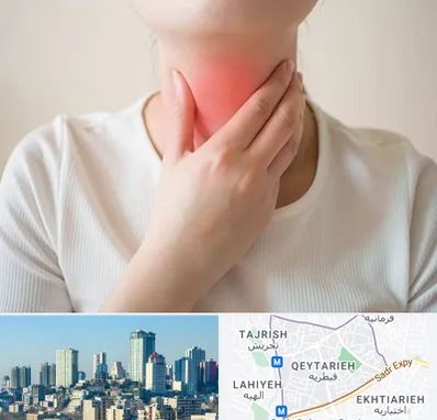 دکتر سرطان مری در قیطریه 