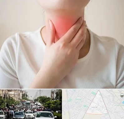 دکتر سرطان مری در سیدی مشهد