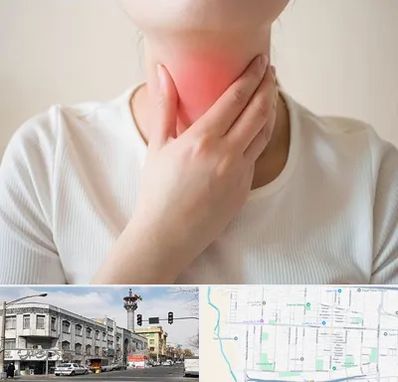 دکتر سرطان مری در 17شهریور